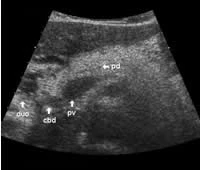 Ultrasound of the pancreas: what normal looks like | AuntMinnie