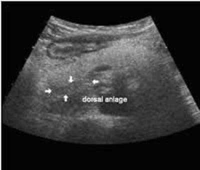 2002 12 16 13 37 29 706