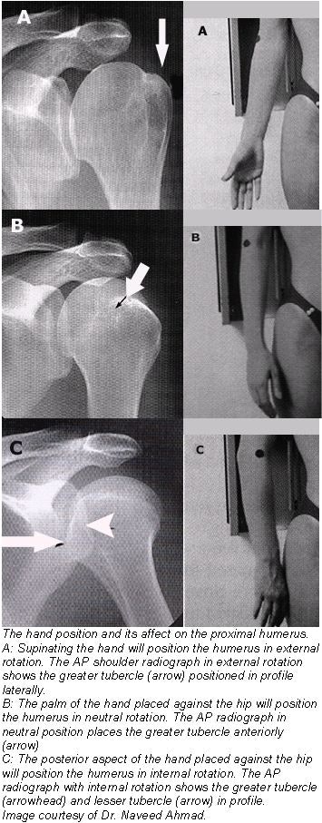Getting the most from shoulder positioning | AuntMinnie