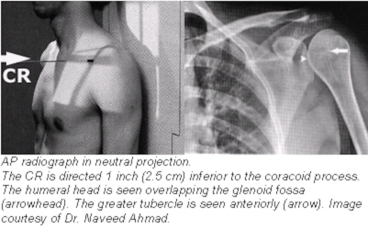 shoulder x ray positions