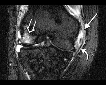 2003 01 08 15 46 30 706