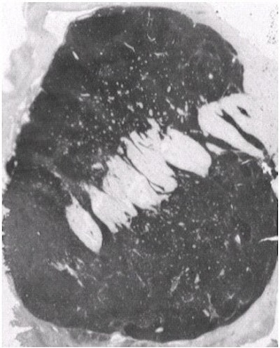 2003 01 17 15 11 49 706