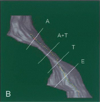 2003 01 23 16 22 47 706