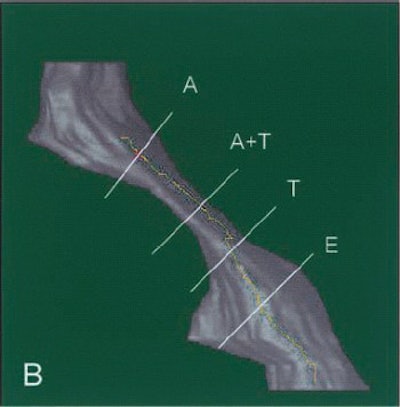 2003 01 23 16 22 47 706