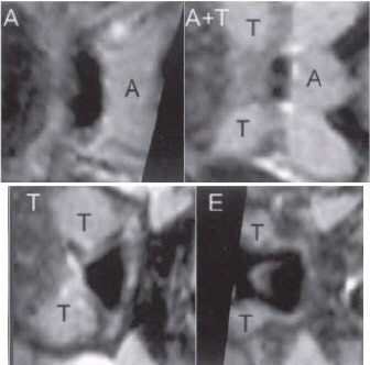 2003 01 23 16 35 04 706