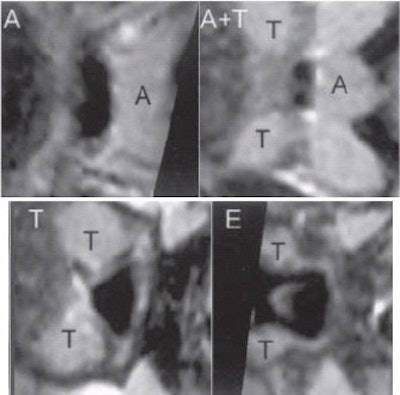 2003 01 23 16 35 04 706