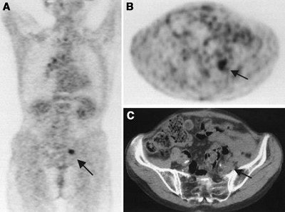 2003 01 24 15 36 06 706