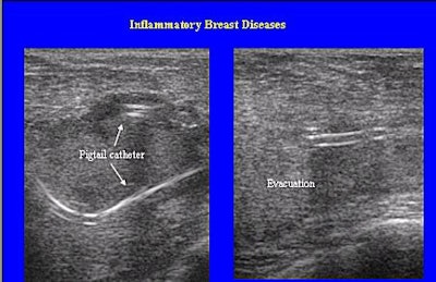 2003 01 27 15 13 15 706