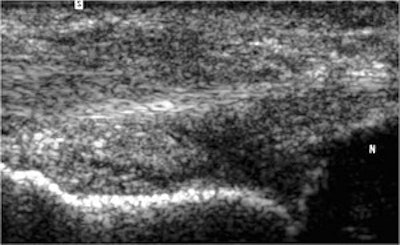 2003 02 11 15 36 43 706