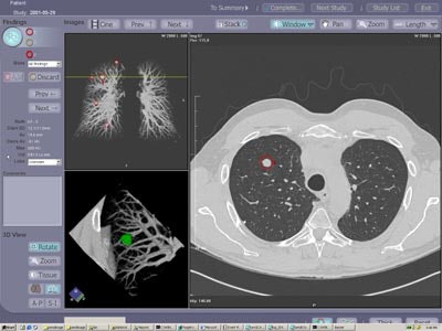 2003 02 12 18 03 18 706