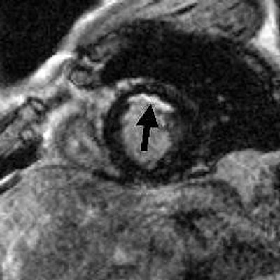 2003 02 13 15 15 44 706