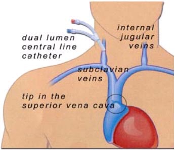 2003 02 22 14 18 17 706