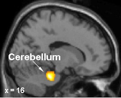 2003 03 03 16 38 28 706