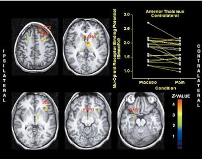 2003 03 17 17 08 55 706