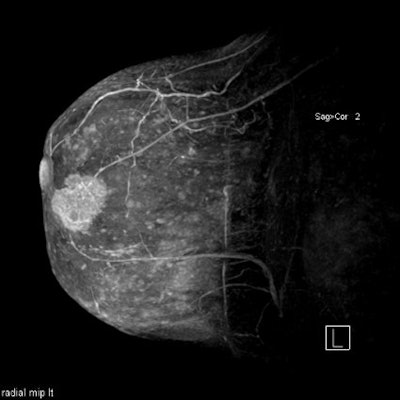 2003 03 19 16 24 55 706