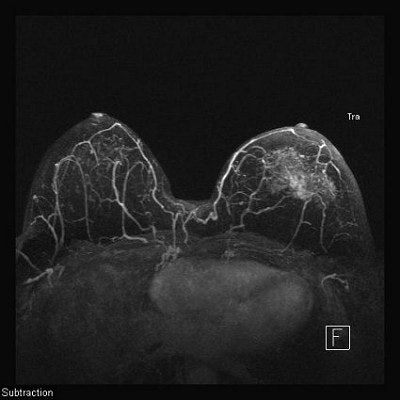 2003 03 19 16 31 22 706