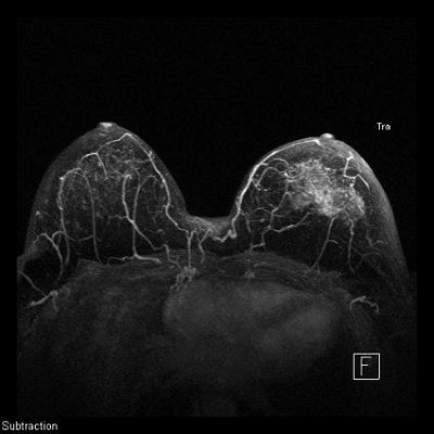 2003 03 19 16 34 21 706