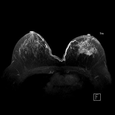 2003 03 19 16 38 43 706