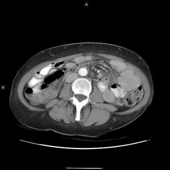 2003 03 26 15 56 00 706