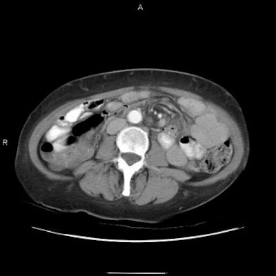 2003 03 26 15 56 00 706