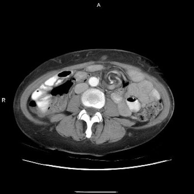 2003 03 26 15 56 34 706