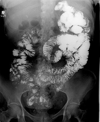 2003 03 26 15 57 03 706