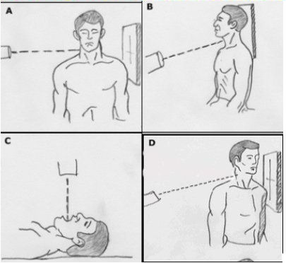 Radiographic positioning techniques for the cervical spine | AuntMinnie
