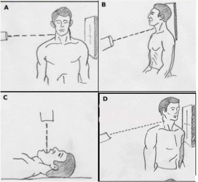 Twining Method Radiography Radiographic positioning techniques for the cervical spine | AuntMinnie