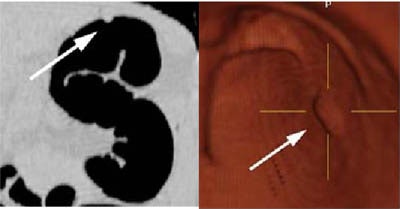 2003 04 07 16 53 05 706