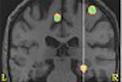 2003 04 11 15 11 36 706