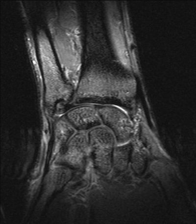 2003 04 14 17 38 33 706