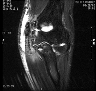 2003 04 14 17 44 01 706