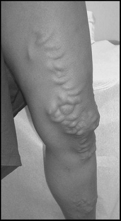 2003 04 18 10 08 13 706