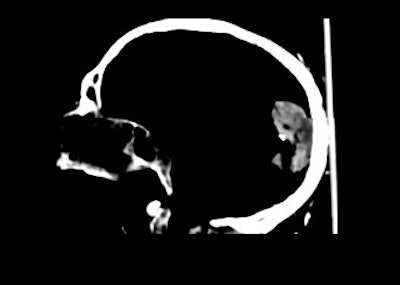 2003 04 22 14 27 36 706