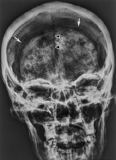 2003 04 22 14 37 17 706