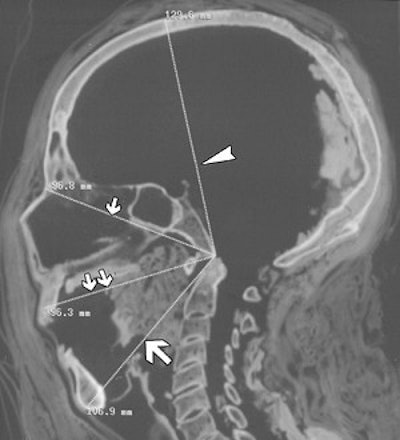 2003 04 22 14 45 54 706