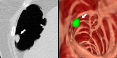 2003 04 22 15 50 13 706