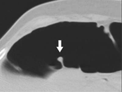 2003 04 22 15 51 55 706