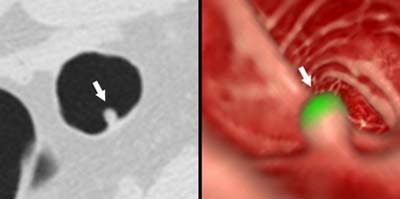 2003 04 22 15 54 36 706