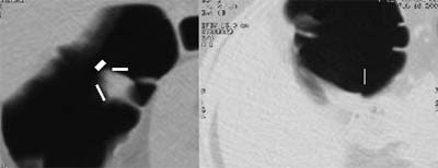 2003 04 22 16 51 10 706