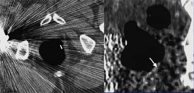 2003 04 22 16 56 35 706