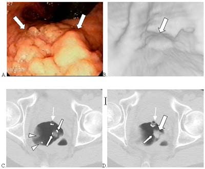 2003 04 23 08 38 57 706