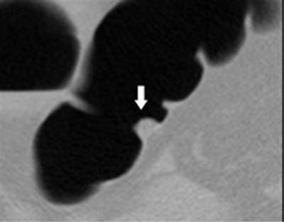 2003 04 23 09 29 23 706