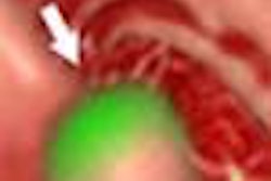 2003 04 23 09 47 17 706