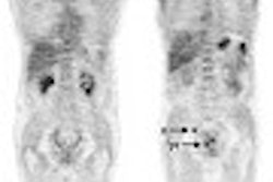2003 04 25 14 20 04 706