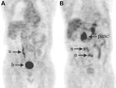 2003 04 25 14 21 10 706