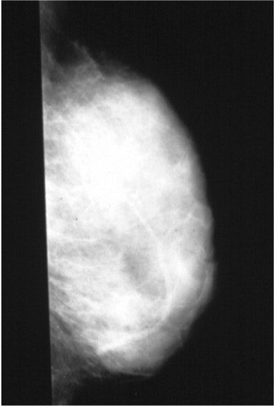 2003 04 25 14 39 55 706