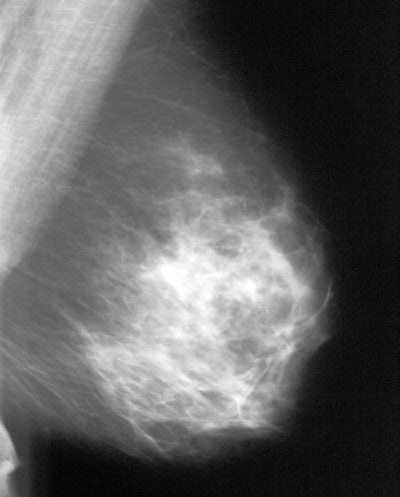 2003 04 28 09 44 25 706