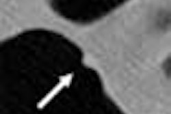 2003 04 28 10 24 26 706