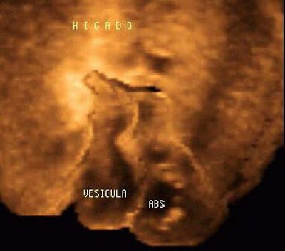 2003 05 02 14 50 34 706